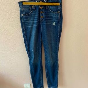Madewell Button-Fly Jeans